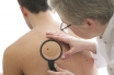 World-first melanoma drug claim