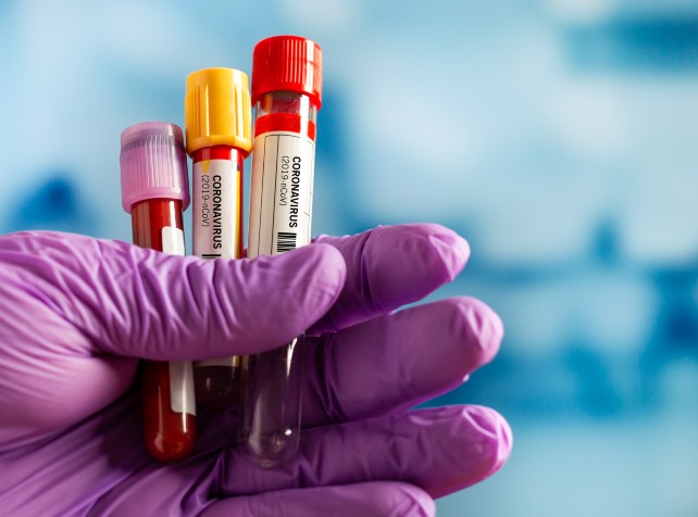 CSL injects $2.3b into US for valuable blood plasm