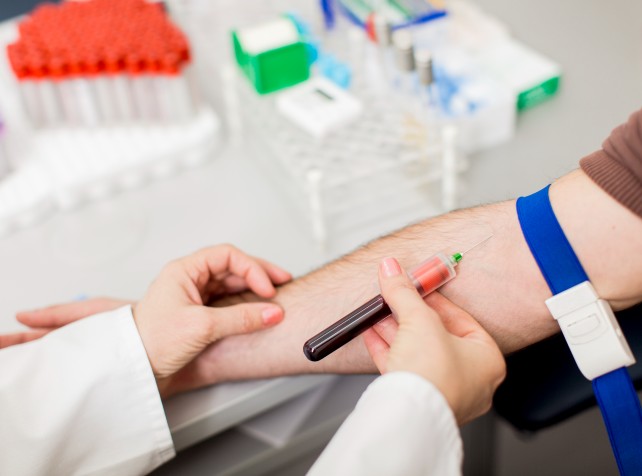 Diagnosing concussion could be as easy as a blood 