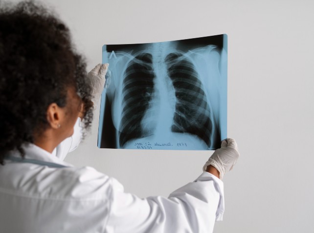 Early lung cancer checks reach 50000 Australians