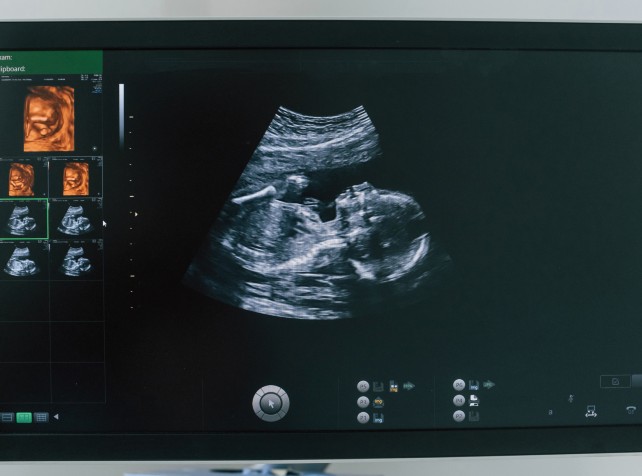 Fertility giant caught up in second embryo mix-up