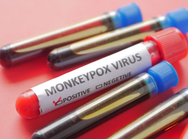 NSW reports local case of monkeypox - HealthTimes
