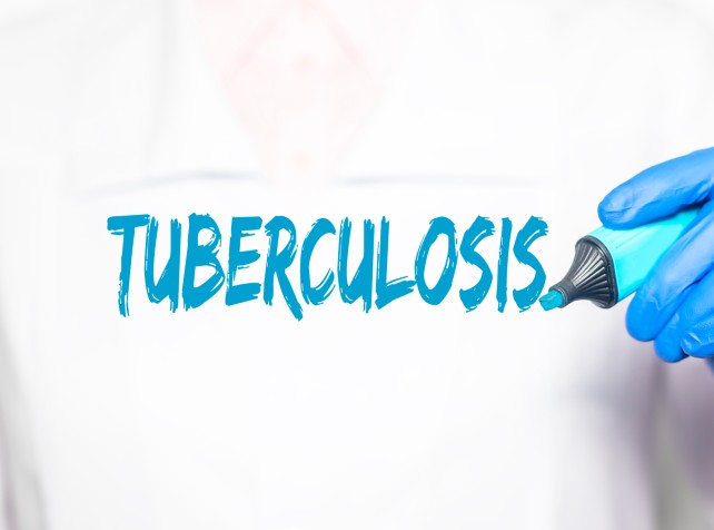 New tuberculosis cases detected amid SA outbreaks
