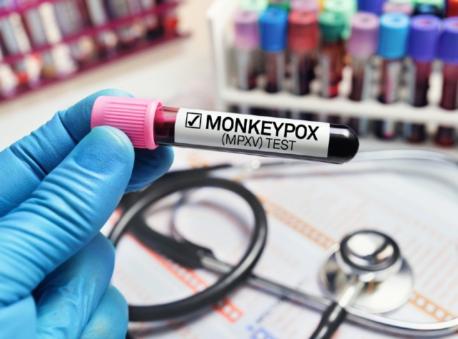South Africa reports second monkeypox death in day