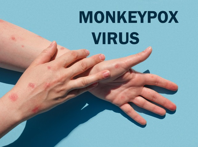 WHO convenes urgent committee on mpox outbreak in 