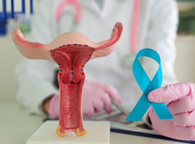 Women's voices amplify push for ovarian cancer tes