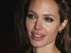 Angelina effect leads to more mastectomies